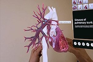 XR心脏解剖学 XR Heart Anatomy (MR-Fix)